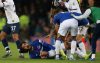 Andre Gomes của Everton chấn thương kinh hoàng